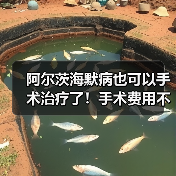 阿尔茨海默病也可以手术治疗了!手术费用不到两万元(图4) 阿尔茨海默病也可以手术治疗了!手术费用不到两万元(图4)