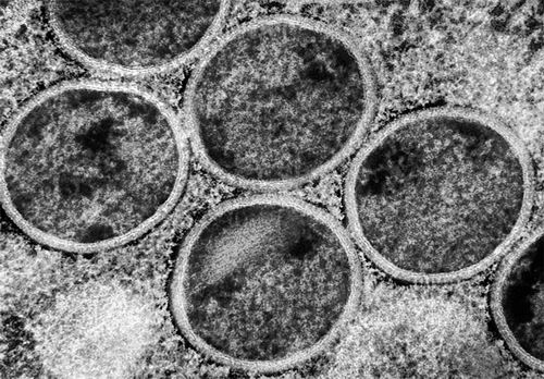 猴痘病毒竟能潜伏睾丸数周，男性生育能力面临未知威胁(图1)